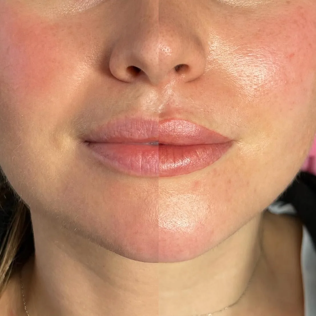 Same photograph split down the middle, untouched on the left and healed on the right