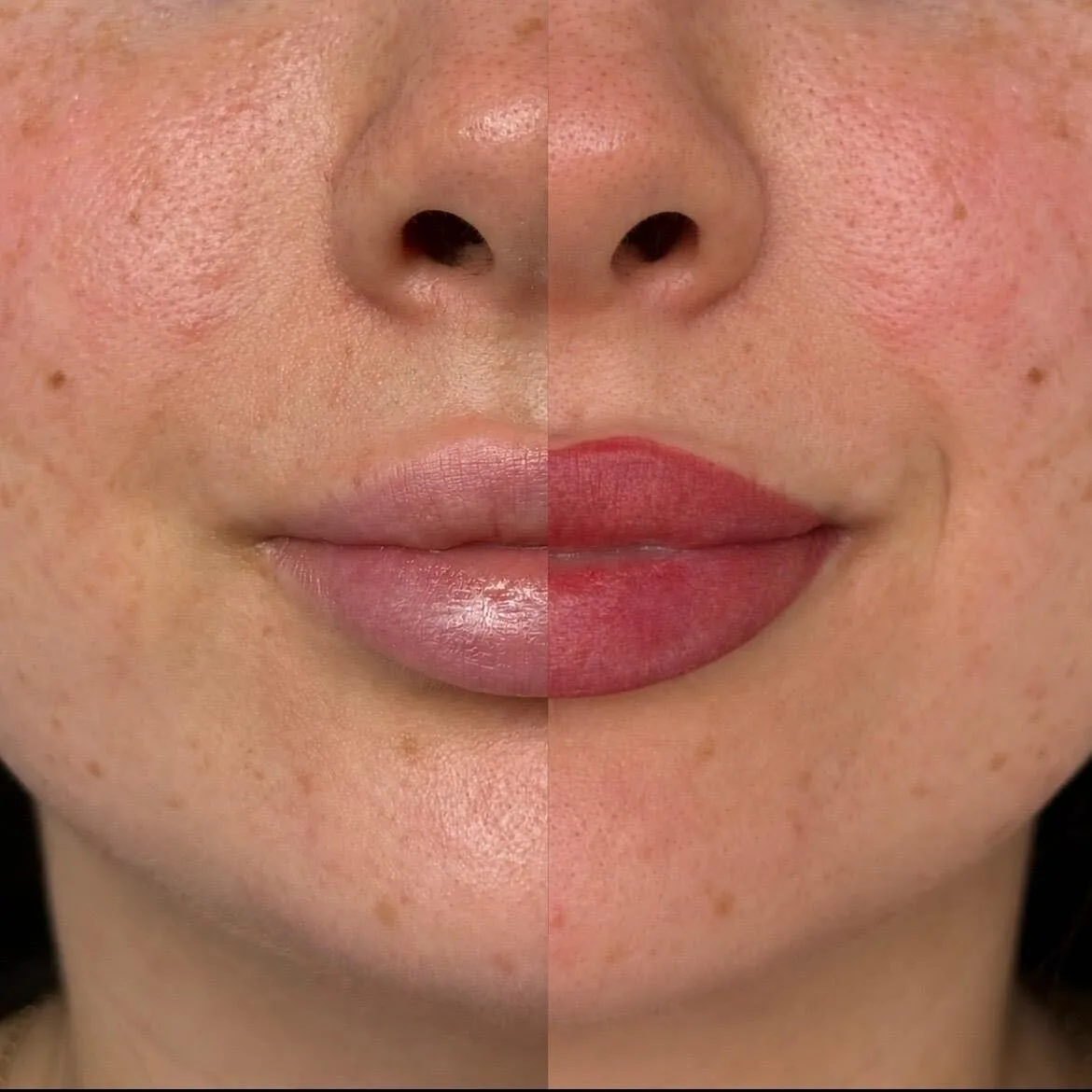 Half and half comparison showing a deeper healed shade