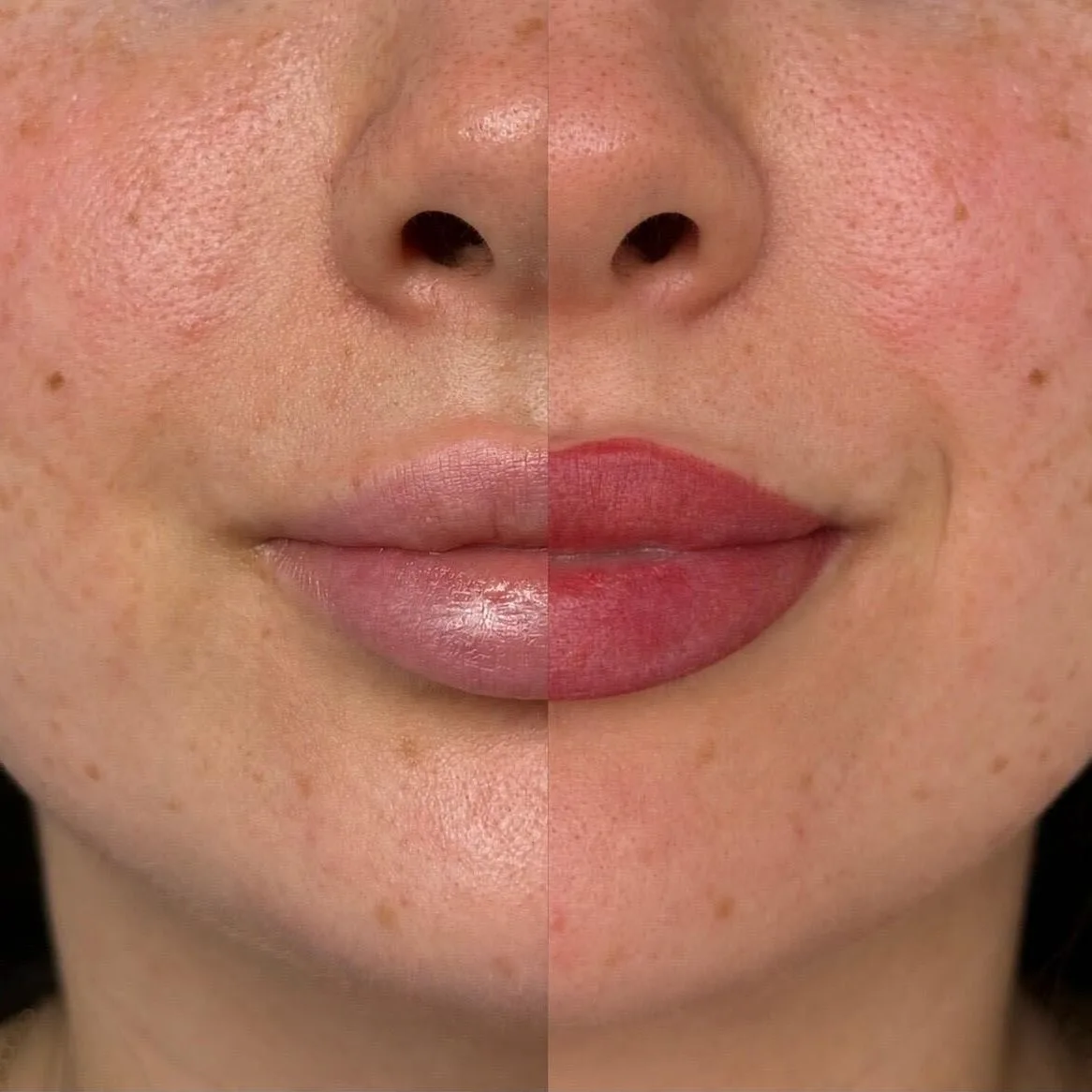 Half and half comparison showing a deeper healed shade