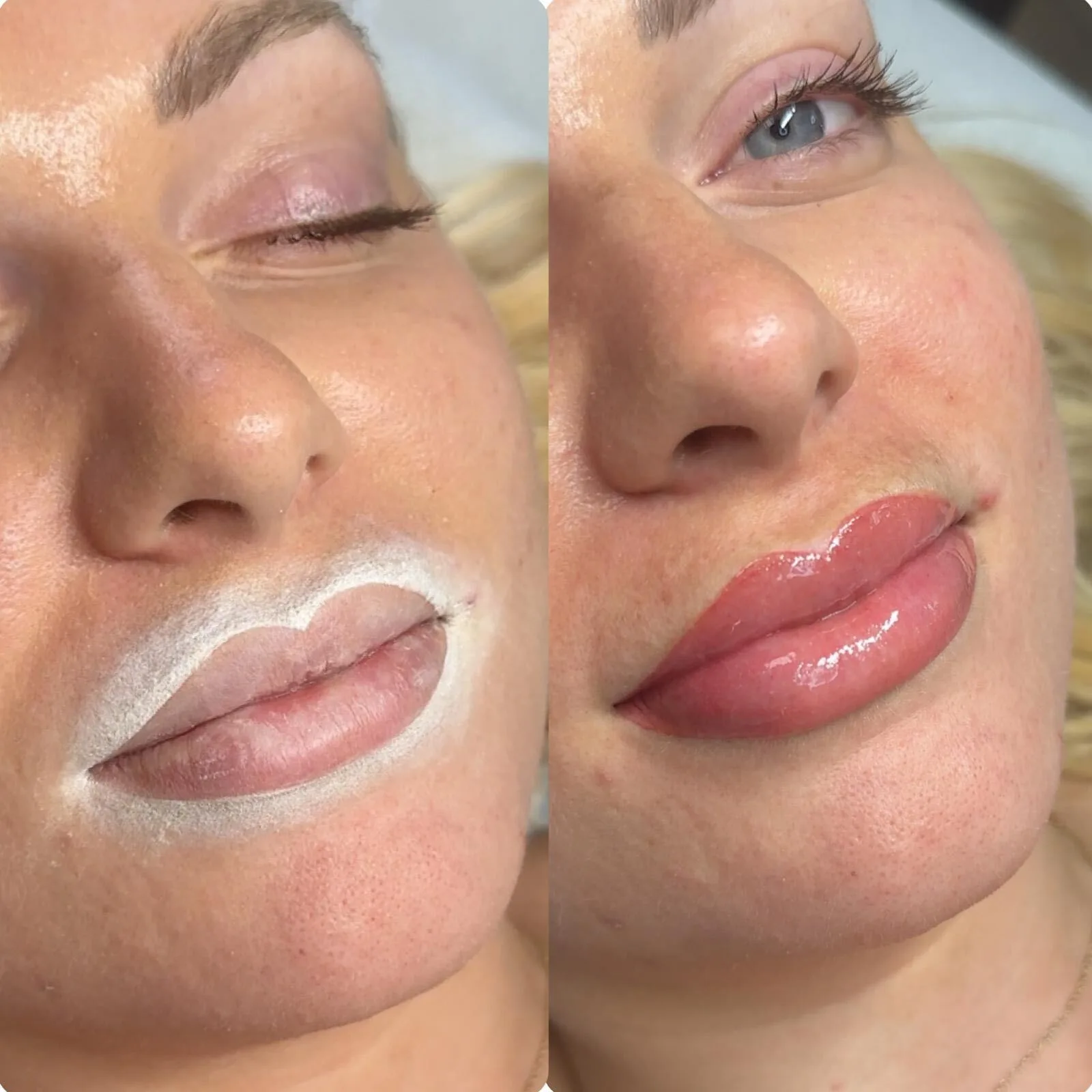 Lips mapped and numbed alongside the finished result