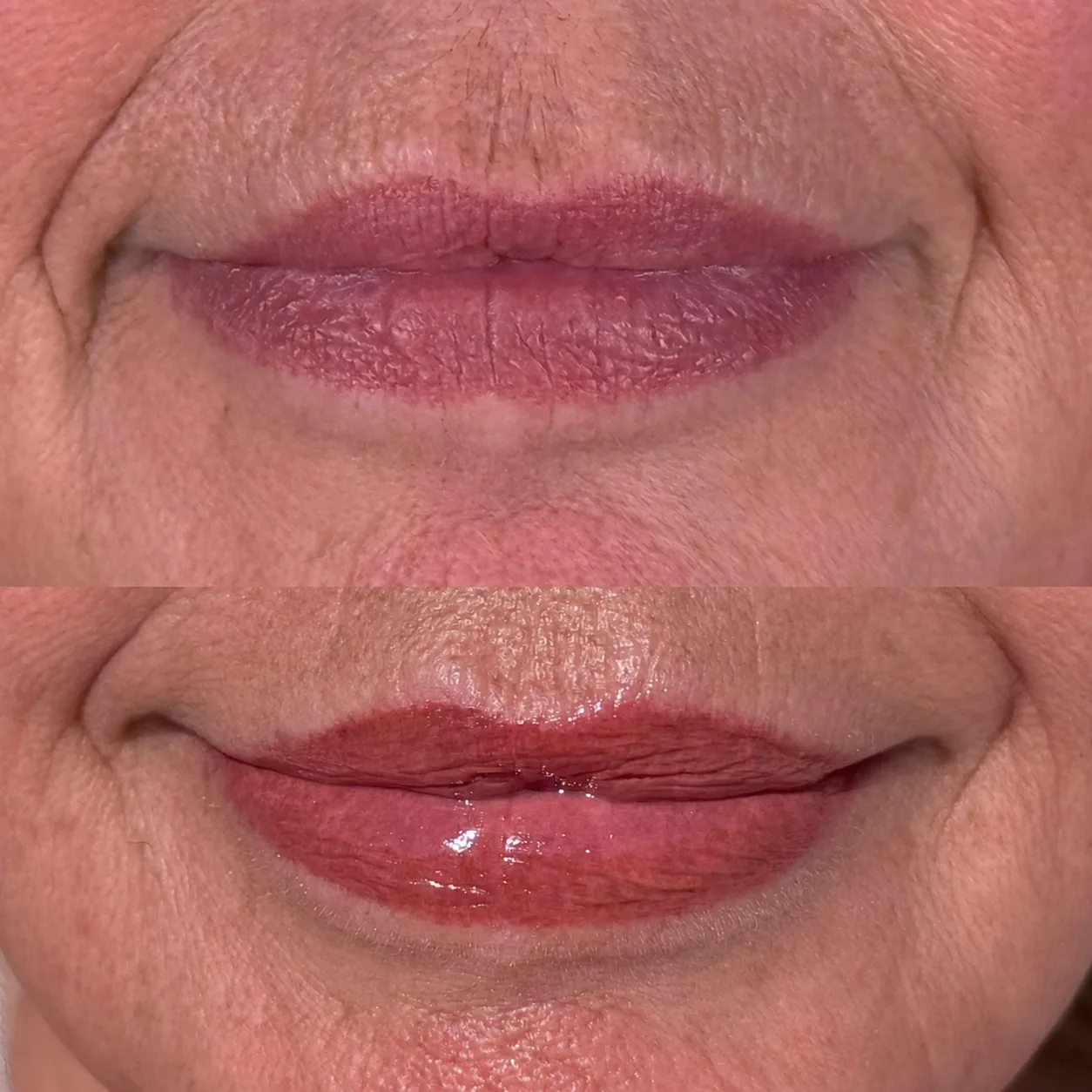 The same lips before and after, stacked, the healed colour warmer and more even