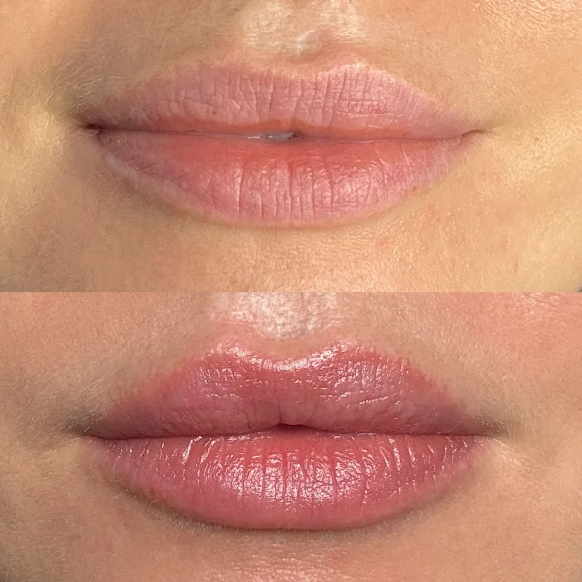 The same lips before and after, stacked, the healed colour deeper and more even