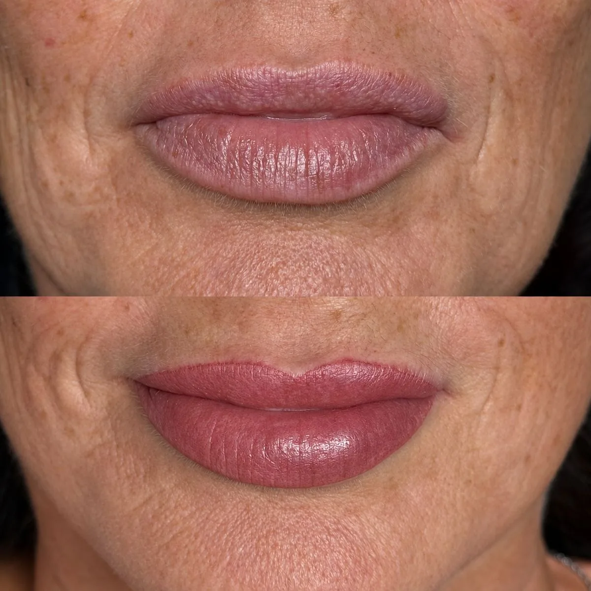 A mature client's lips before and after, stacked, the shape redefined and the colour restored